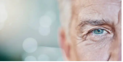 LASIK eye surgery